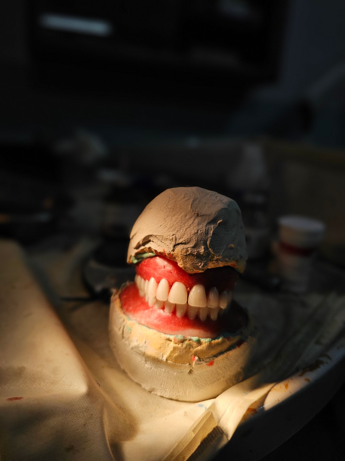 Denture model prepared in a dental lab